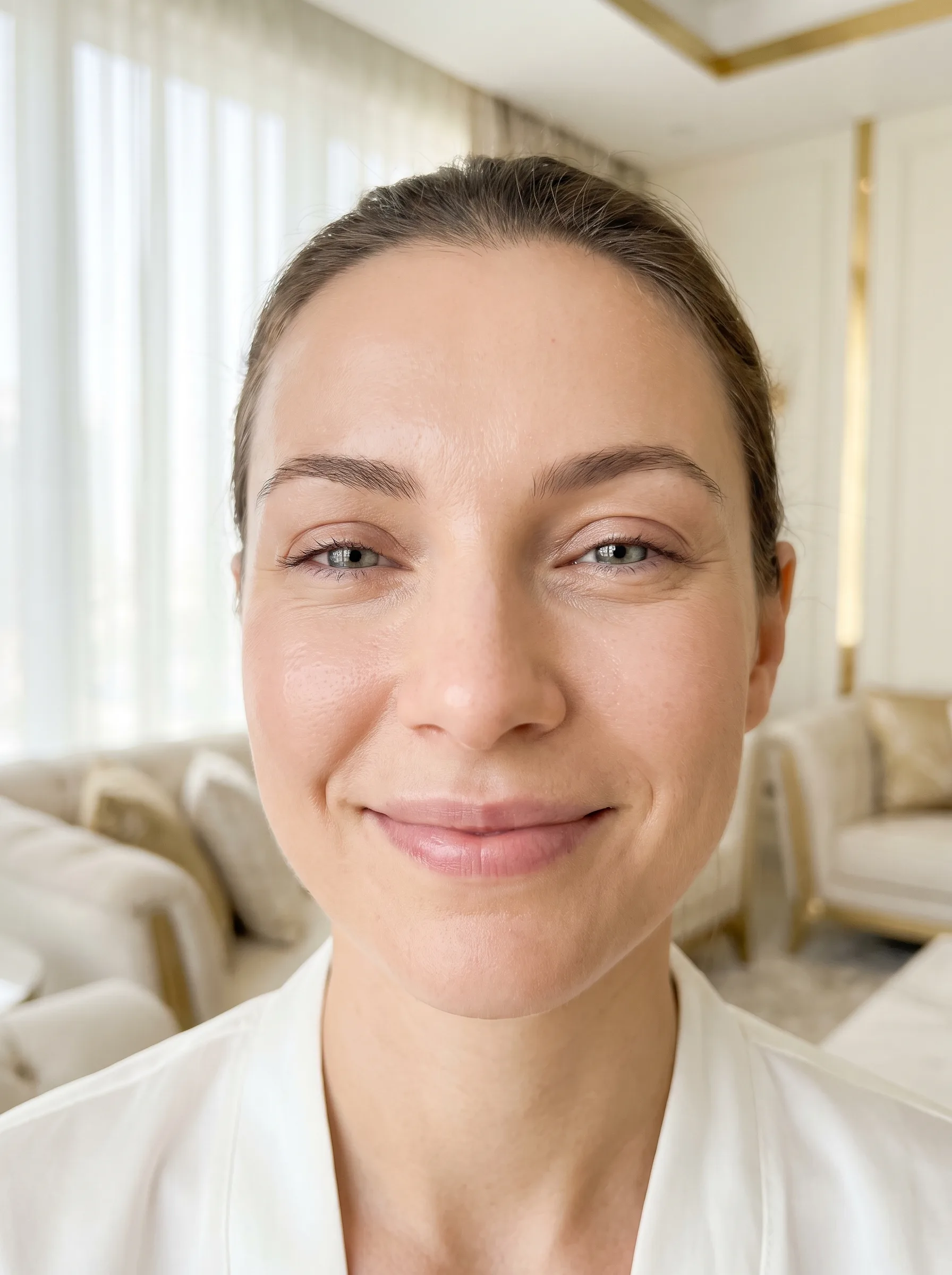 Bright youthful eyes — blepharoplasty candidate in Dubai